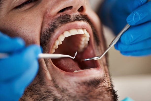 Best Tooth Infection Emergency Dentist  in Brilliant, OH
