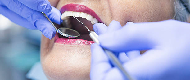 Best Knocked-Out Tooth Emergency  in Brilliant, OH
